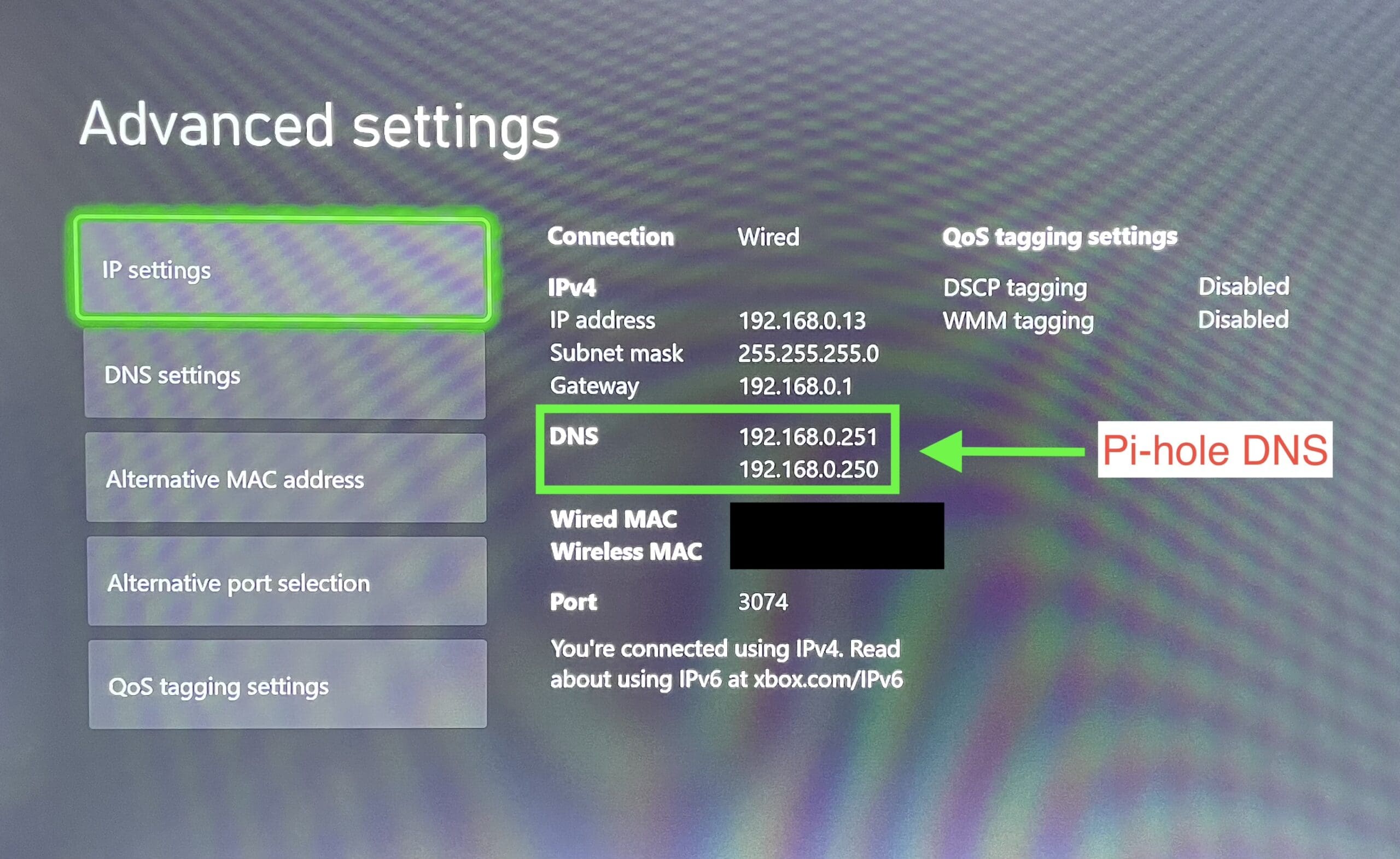 xbox-dns - Open Source Society Malta